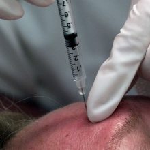 Fake Botox is Common. Here’s What To Watch Out For.