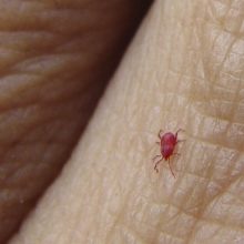 What to Know About Chiggers Bites, Symptoms and Treatment