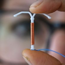 Health Officials Urge Doctors to Address IUD Insertion Pain