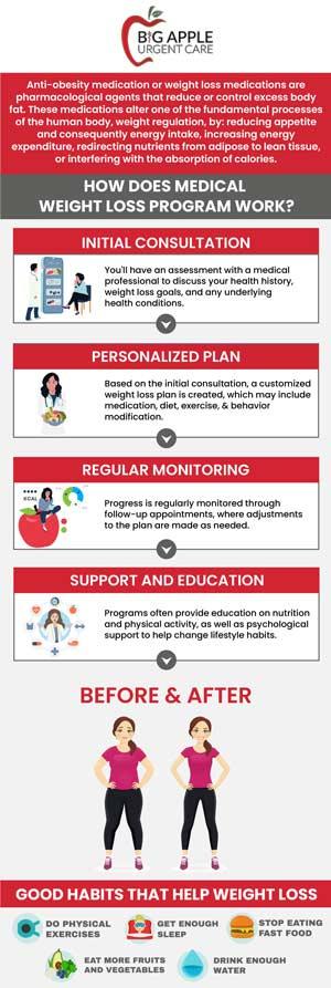 Should I seek the advice of a nutritionist or dietician for customized weight reduction recommendation?